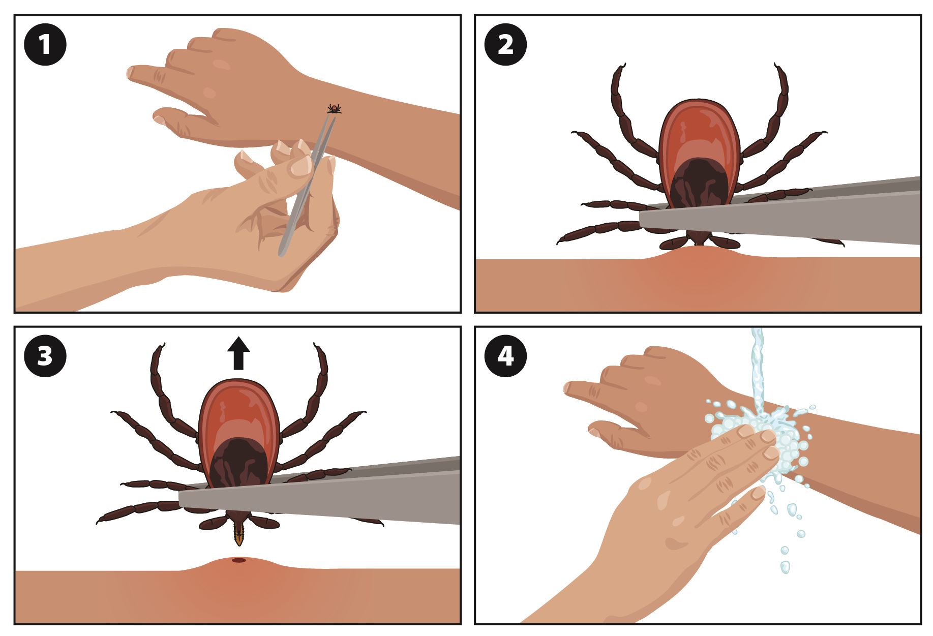 tick removal